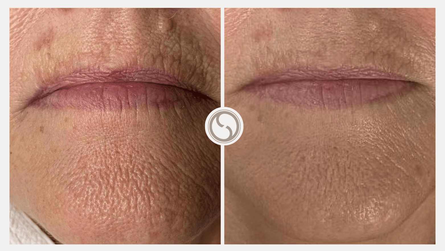 Dermatude Resultaten 7